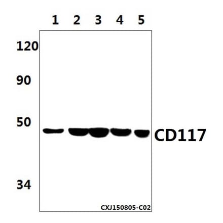 Anti-CD117 (1A9) Antibody from Bioworld Technology (MB8588) - Antibodies.com