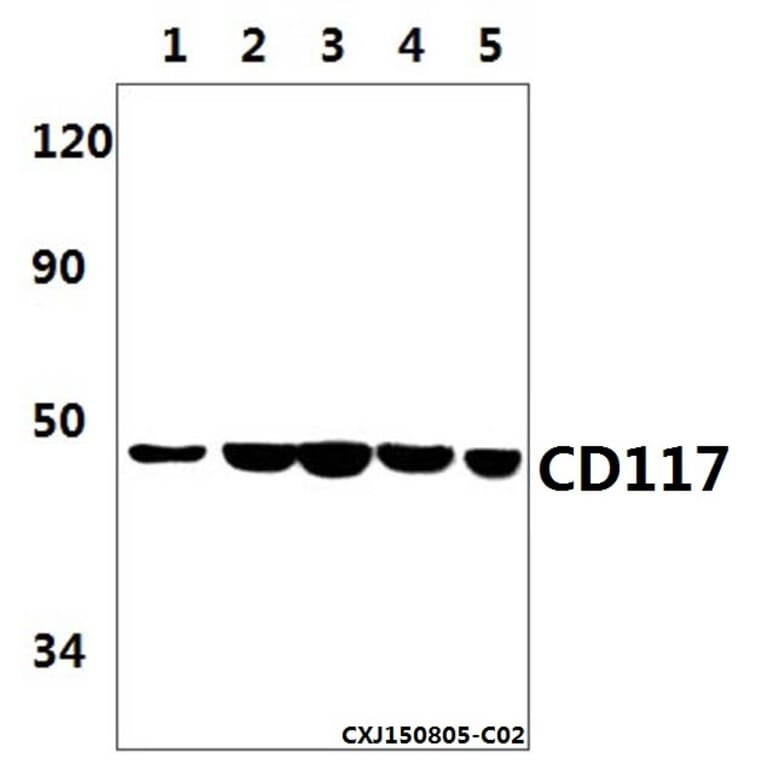 Anti-CD117 (1A9) Antibody from Bioworld Technology (MB8588) - Antibodies.com