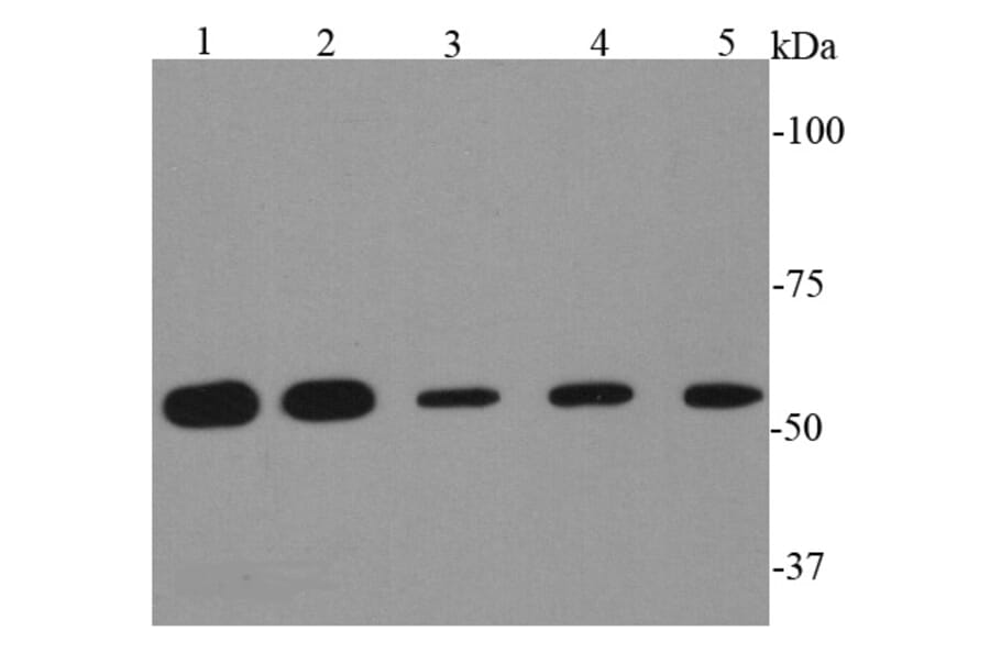 Anti-HSP60 Antibody from Bioworld Technology (MB9002) - Antibodies.com