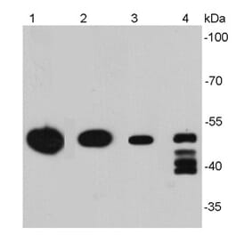 Anti-Vimentin Antibody from Bioworld Technology (MB9006) - Antibodies.com