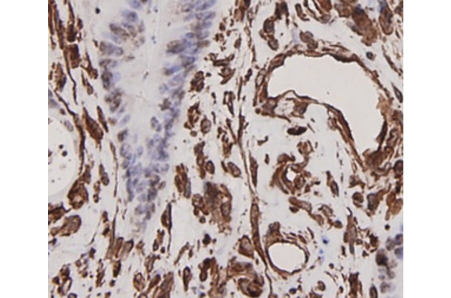 Anti-Vimentin Antibody from Bioworld Technology (MB9006) - Antibodies.com