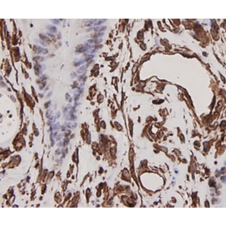 Anti-Vimentin Antibody from Bioworld Technology (MB9006) - Antibodies.com