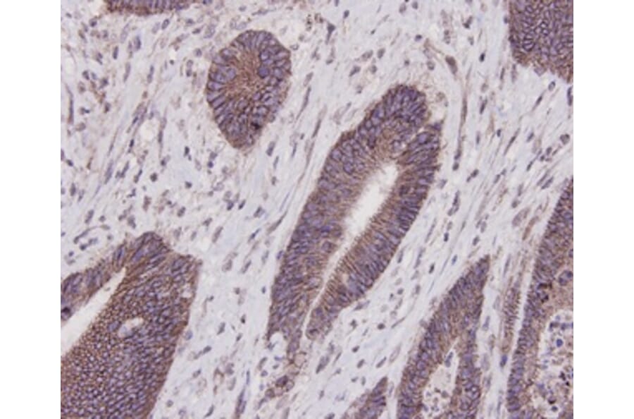 Anti-E-Cadherin Antibody from Bioworld Technology (MB9007) - Antibodies.com