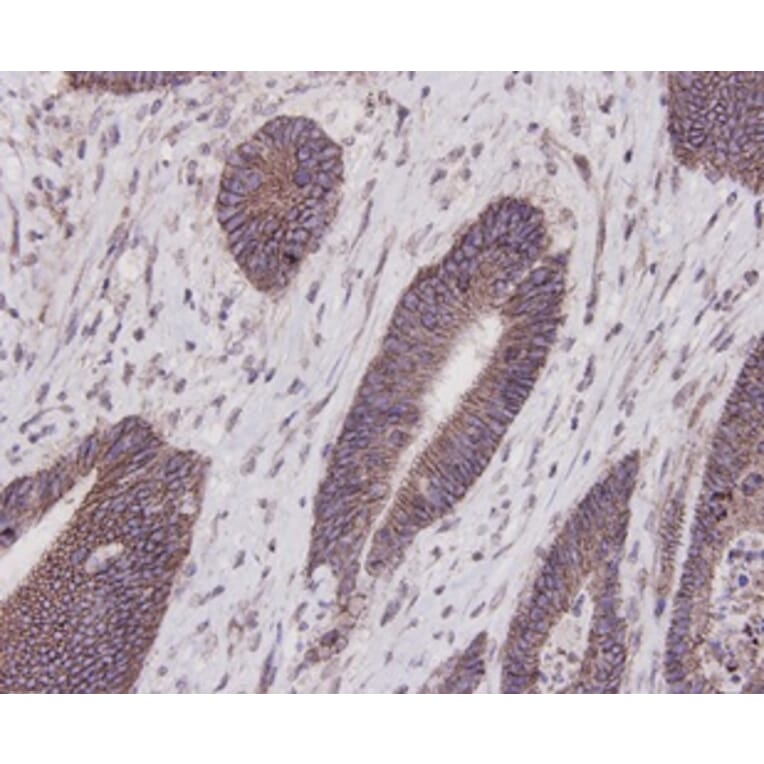 Anti-E-Cadherin Antibody from Bioworld Technology (MB9007) - Antibodies.com