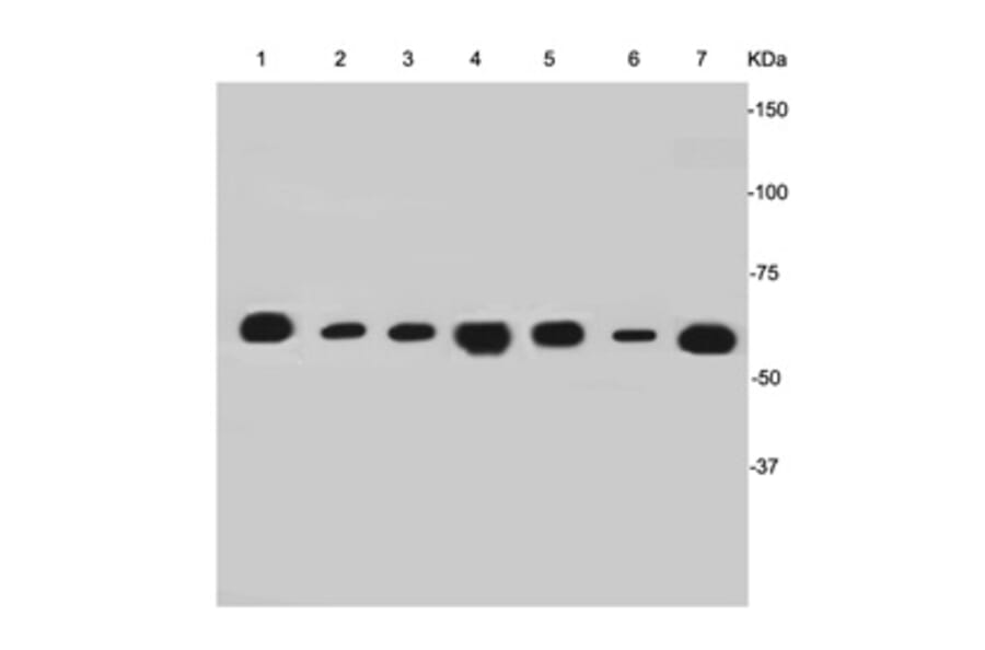 Anti-Cytokeratin-7 Antibody from Bioworld Technology (MB9008) - Antibodies.com