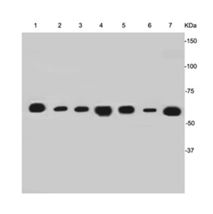 Anti-Cytokeratin-7 Antibody from Bioworld Technology (MB9008) - Antibodies.com