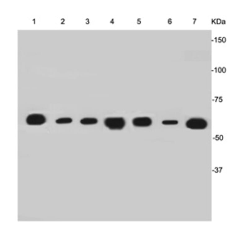 Anti-Cytokeratin-7 Antibody from Bioworld Technology (MB9008) - Antibodies.com