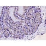 Anti-SQSTM1 Antibody from Bioworld Technology (MB9009) - Antibodies.com