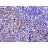 Anti-SQSTM1 Antibody from Bioworld Technology (MB9009) - Antibodies.com