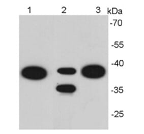 Anti-EPCAM Antibody from Bioworld Technology (MB9010) - Antibodies.com