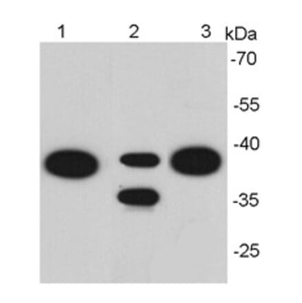 Anti-EPCAM Antibody from Bioworld Technology (MB9010) - Antibodies.com