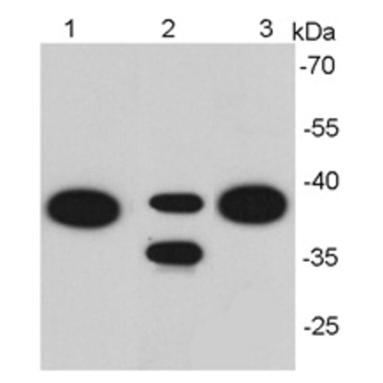 Anti-EPCAM Antibody from Bioworld Technology (MB9010) - Antibodies.com
