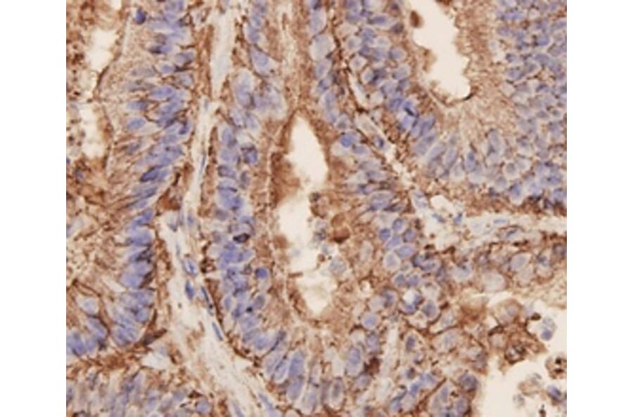 Anti-EPCAM Antibody from Bioworld Technology (MB9010) - Antibodies.com