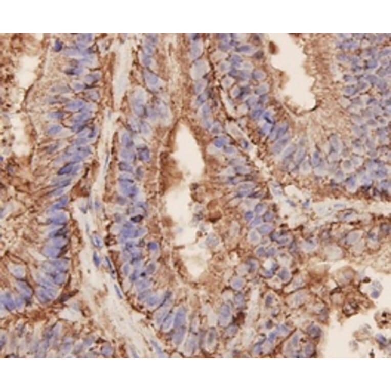 Anti-EPCAM Antibody from Bioworld Technology (MB9010) - Antibodies.com
