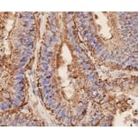 Anti-EPCAM Antibody from Bioworld Technology (MB9010) - Antibodies.com