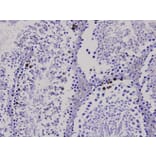 Anti-Bax Antibody from Bioworld Technology (MB9013) - Antibodies.com