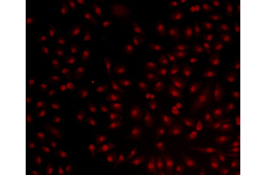 Anti-Bmi1 Antibody from Bioworld Technology (MB9014) - Antibodies.com