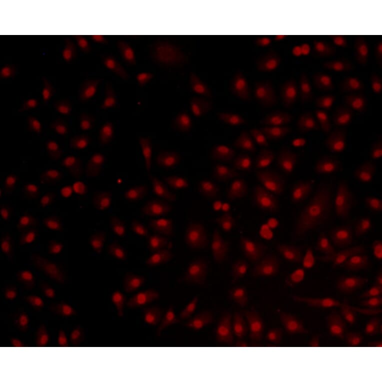 Anti-Bmi1 Antibody from Bioworld Technology (MB9014) - Antibodies.com