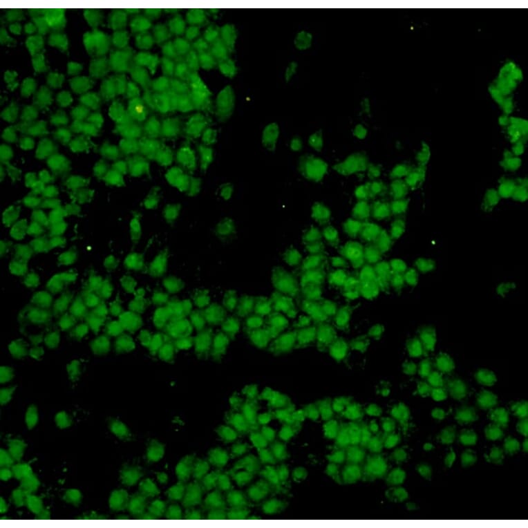 Anti-p53 Antibody from Bioworld Technology (MB9015) - Antibodies.com