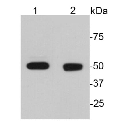 Anti-GFAP Antibody from Bioworld Technology (MB9017) - Antibodies.com