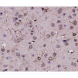 Anti-GFAP Antibody from Bioworld Technology (MB9017) - Antibodies.com