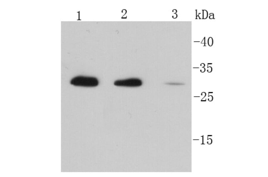 Anti-IL-6 Antibody from Bioworld Technology (MB9020) - Antibodies.com