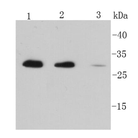 Anti-IL-6 Antibody from Bioworld Technology (MB9020) - Antibodies.com