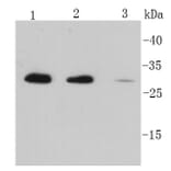 Anti-IL-6 Antibody from Bioworld Technology (MB9020) - Antibodies.com