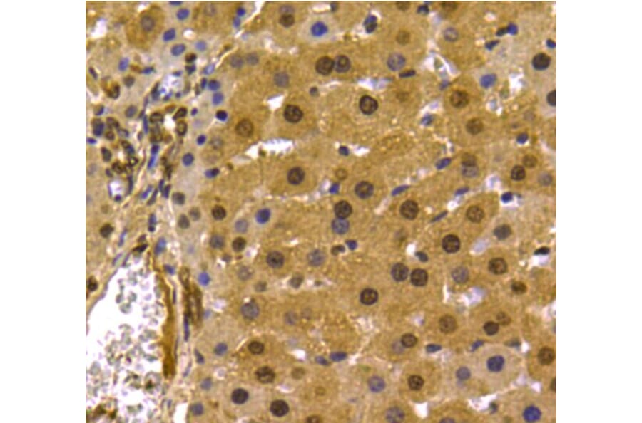 Anti-PRMT5 Antibody from Bioworld Technology (MB9022) - Antibodies.com