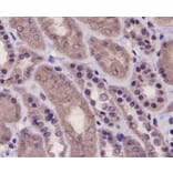 Anti-PRMT5 Antibody from Bioworld Technology (MB9022) - Antibodies.com