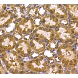 Anti-PRMT5 Antibody from Bioworld Technology (MB9022) - Antibodies.com
