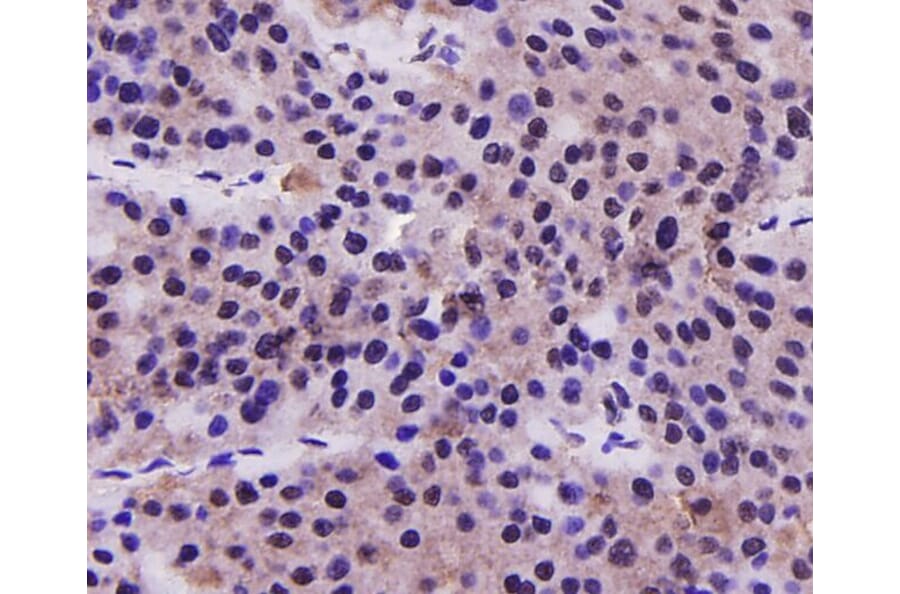 Anti-PRMT5 Antibody from Bioworld Technology (MB9022) - Antibodies.com