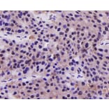 Anti-PRMT5 Antibody from Bioworld Technology (MB9022) - Antibodies.com
