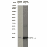 Western Blot - Anti-TGF beta Antibody (MO-C40009E) - Antibodies.com