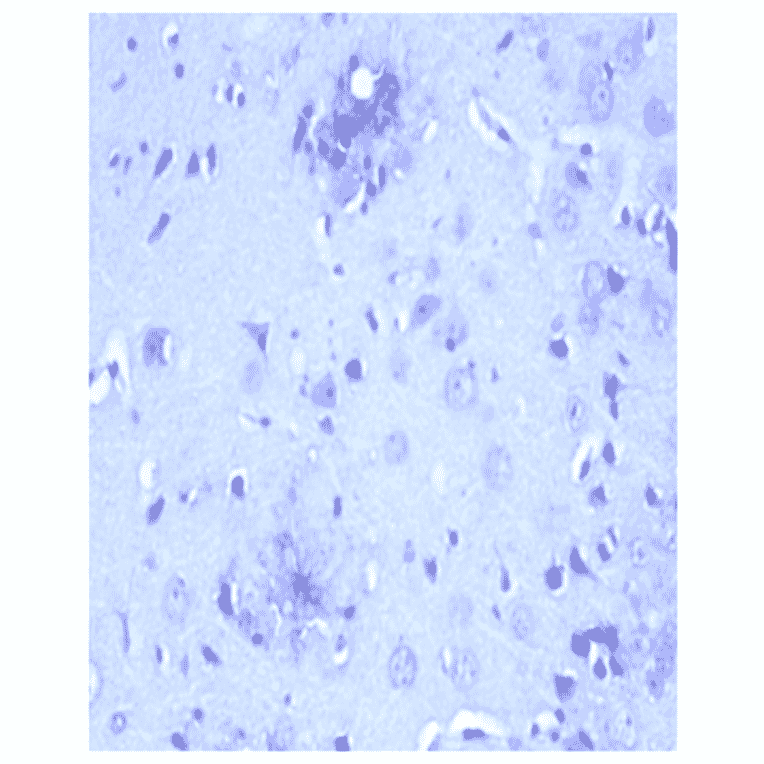 Western Blot - Anti-beta Amyloid Peptide 42 Antibody (MO-M40094E) - Antibodies.com