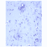 Western Blot - Anti-beta Amyloid Peptide 42 Antibody (MO-M40094E) - Antibodies.com