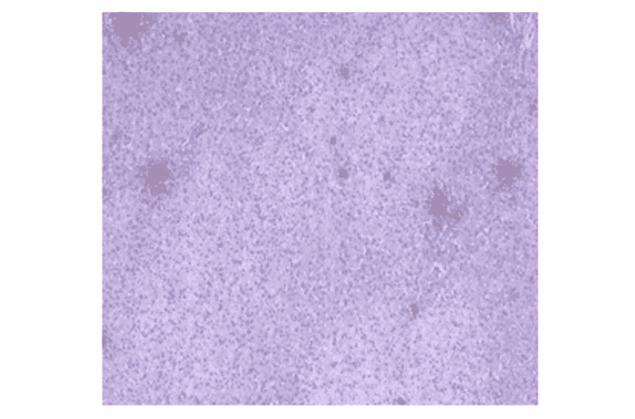 Immunohistochemistry - Anti-CA 125 Antibody (MO-T40012A) - Antibodies.com