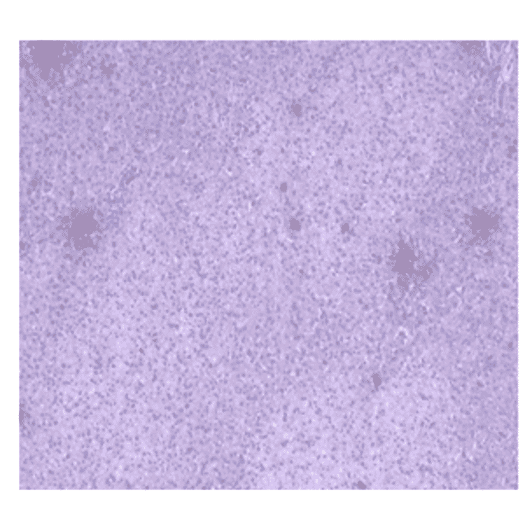 Immunohistochemistry - Anti-CA 125 Antibody (MO-T40012A) - Antibodies.com