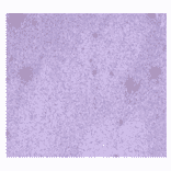 Immunohistochemistry - Anti-CA 125 Antibody (MO-T40012A) - Antibodies.com