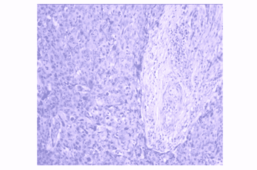 Immunohistochemistry - Anti-CA 125 Antibody (MO-T40012A) - Antibodies.com