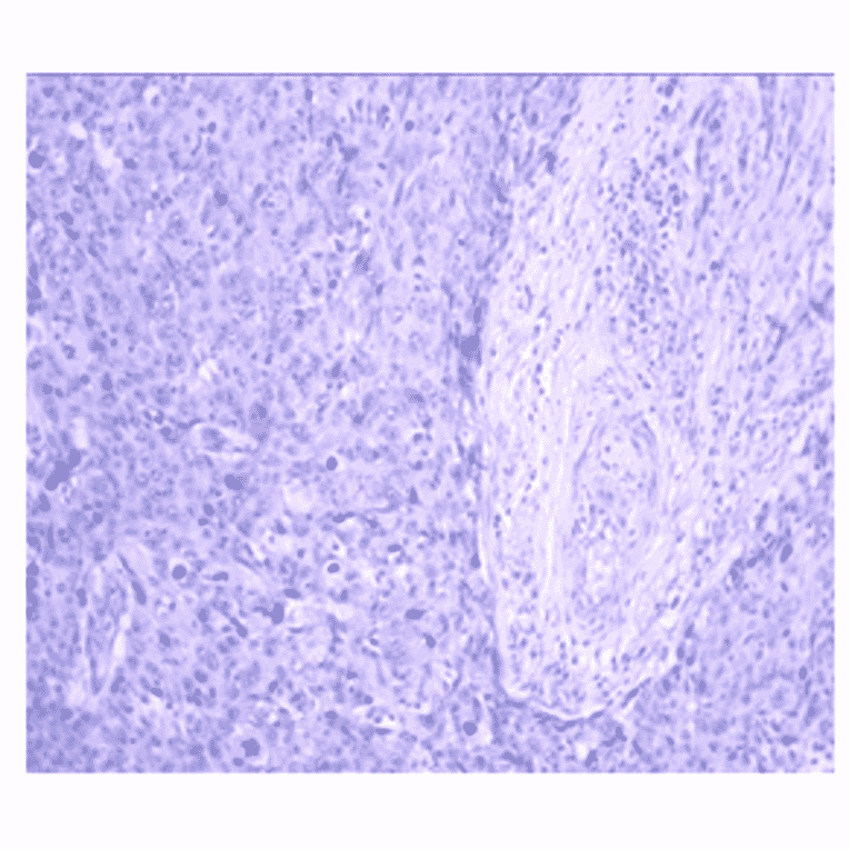 Immunohistochemistry - Anti-CA 125 Antibody (MO-T40012A) - Antibodies.com