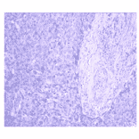 Immunohistochemistry - Anti-CA 125 Antibody (MO-T40012A) - Antibodies.com