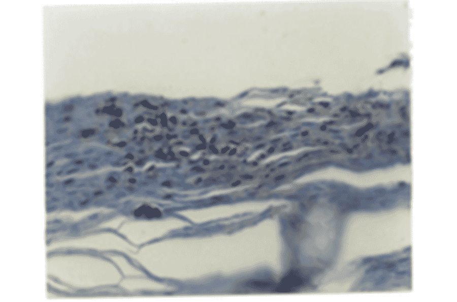 Immunohistochemistry - Anti-IL8 Antibody (MO-C40017D) - Antibodies.com