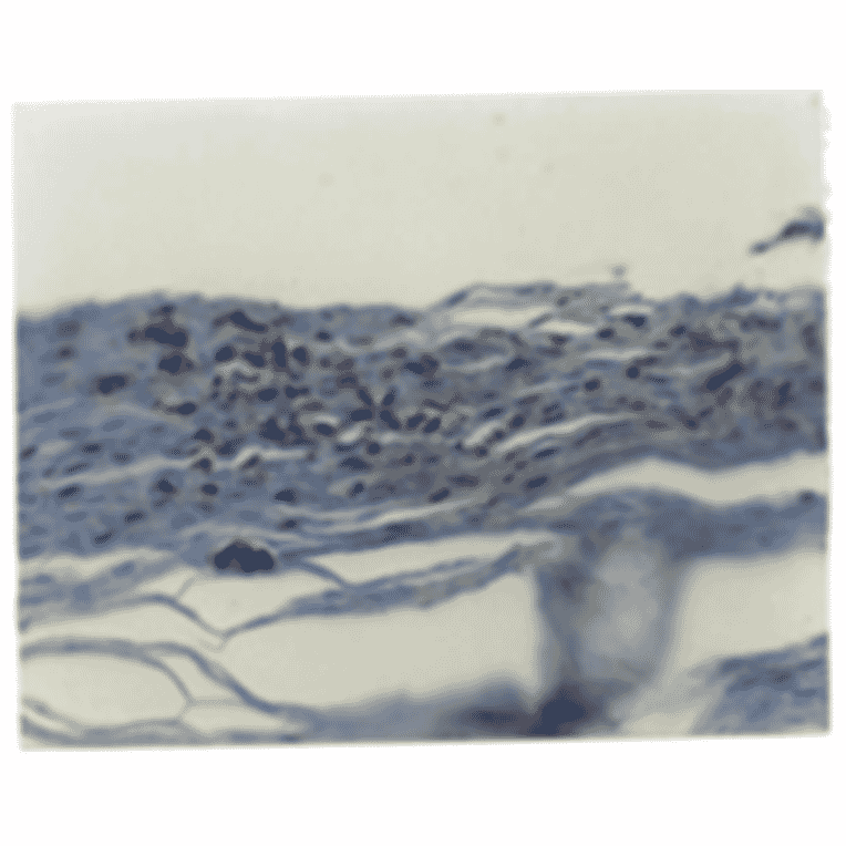 Immunohistochemistry - Anti-IL8 Antibody (MO-C40017D) - Antibodies.com