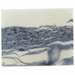 Immunohistochemistry - Anti-IL8 Antibody (MO-C40017D) - Antibodies.com