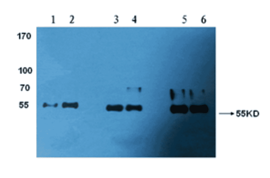 Western Blot - Anti-Factor X Antibody (MO-M40039) - Antibodies.com