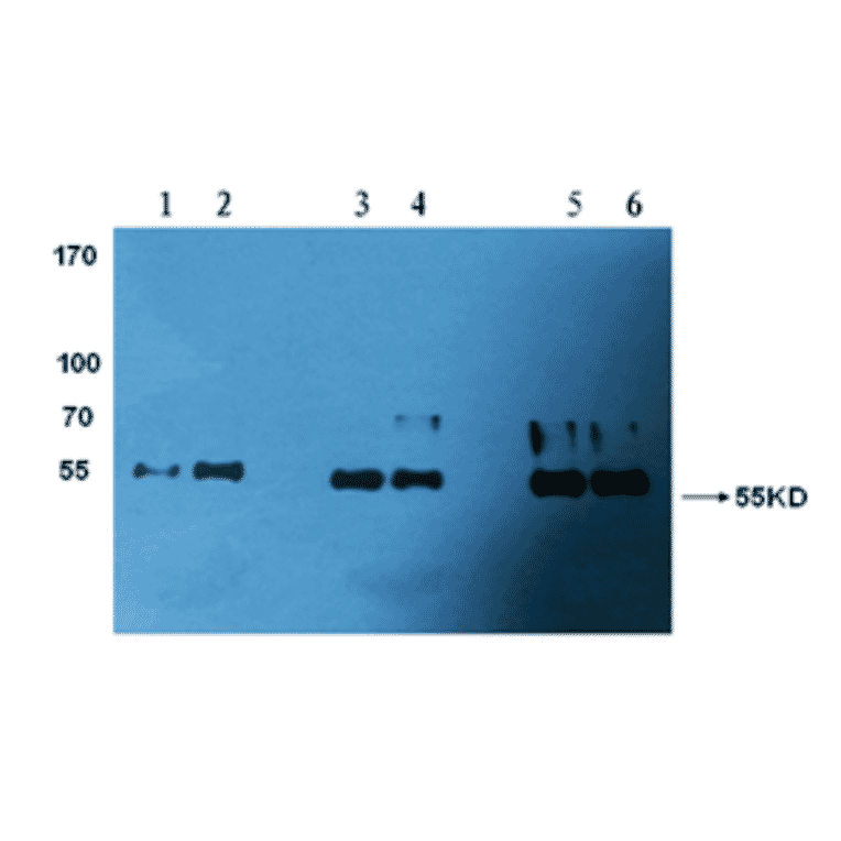 Western Blot - Anti-Factor X Antibody (MO-M40039) - Antibodies.com