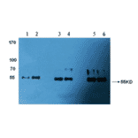 Western Blot - Anti-Factor X Antibody (MO-M40039) - Antibodies.com