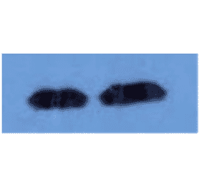 Western Blot - Anti-beta 2 Microglobulin Antibody (MO-M40021D) - Antibodies.com