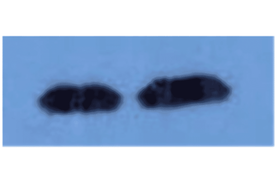 Western Blot - Anti-beta 2 Microglobulin Antibody (MO-M40021D) - Antibodies.com